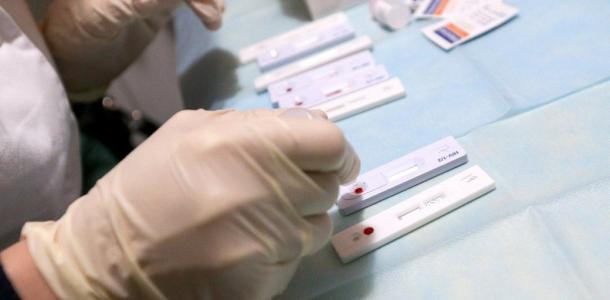 На Днепропетровщине зафиксировали очаг вирусного гепатита и 5 очагов бешенства