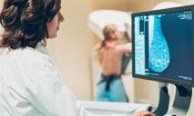 Жительниц Днепра и области призывают массово делать маммографию: где продиагностируют бесплатно