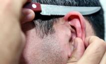 В Днепре неизвестные отрезали мужчине ухо: что говорят в полиции