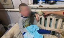 В Днепре 5-летний мальчик застрял рукой в батарее отопления