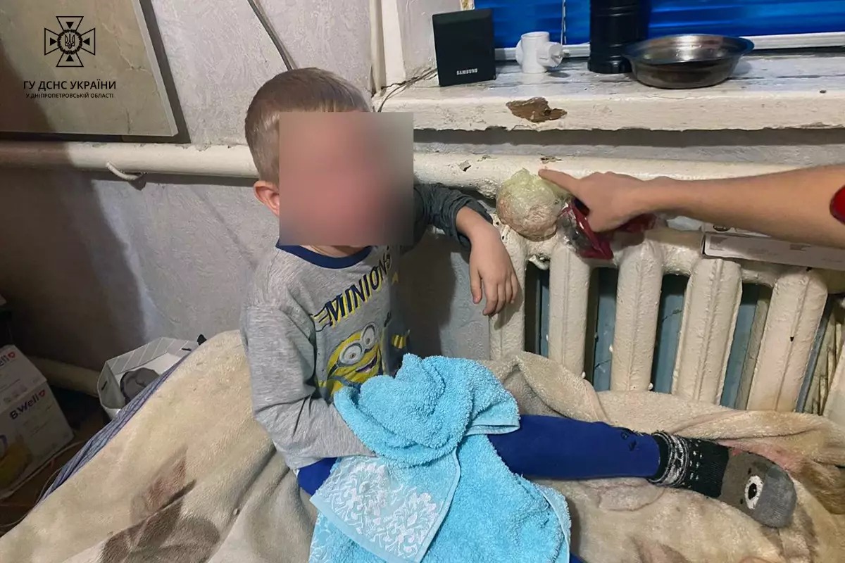Новости Днепра про У Дніпрі 5-річний хлопчик застряг рукою в батареї опалення