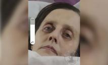 Помогите найти: в Днепропетровской области исчезла 47-летняя женщина с проблемами походки и зрения